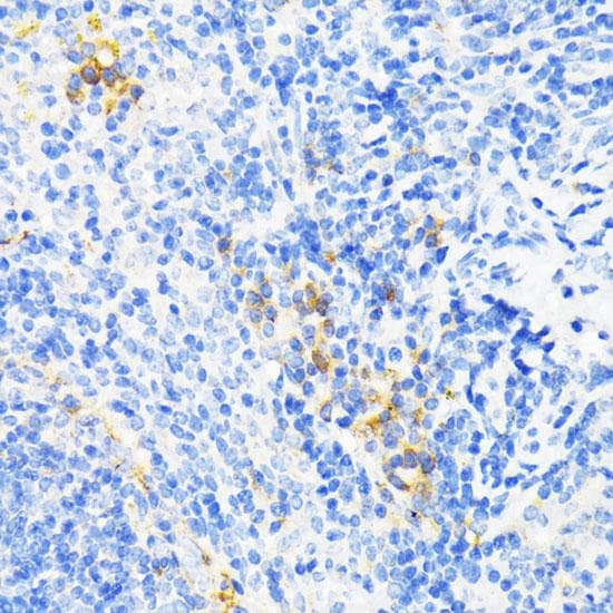LL37 / Cathelicidin Antibody