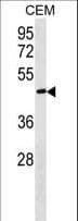 FBLN5 / Fibulin 5 Antibody (aa393-421)