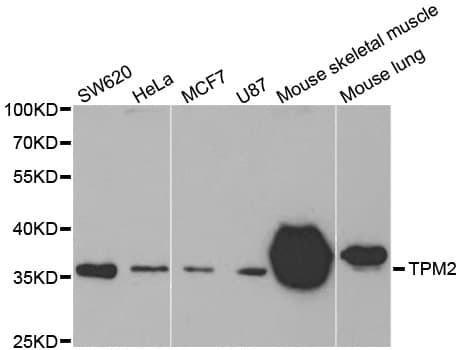 IHC-plus™ TPM2 Antibody