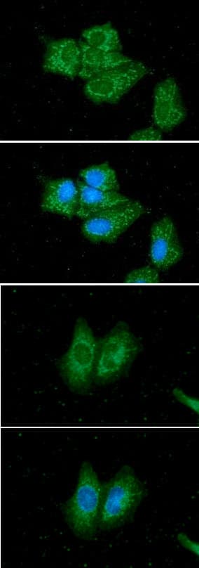 SCAD / ACADS Antibody (clone AT8B10)