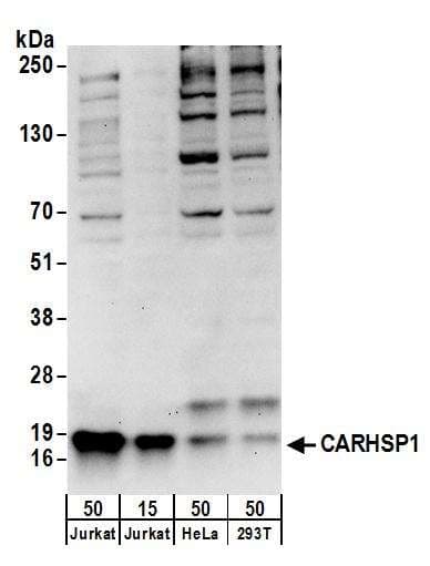 IHC-plus™ Polyclonal Rabbit anti-Human CAPRIN1 Antibody (aa450-500, IHC, WB)