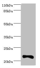 IFNA10 / Interferon Alpha 10 Antibody
