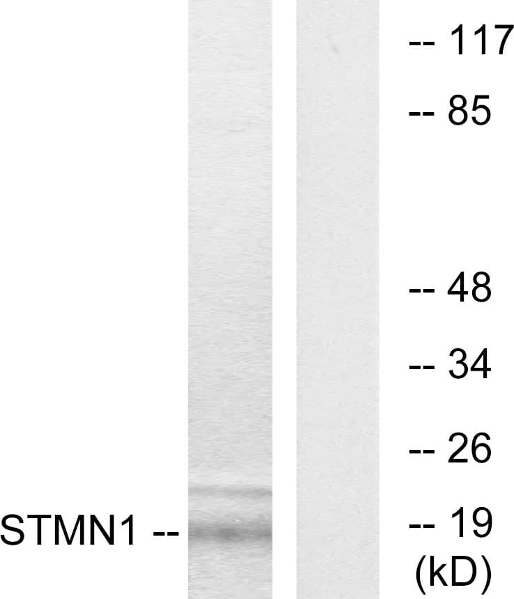 PathPlus™ Polyclonal Rabbit anti-Human STMN1 / Stathmin / LAG Antibody (aa5-54, IHC, IF, WB)