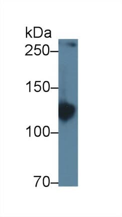 AMPH / Amphiphysin Antibody (aa24-240)