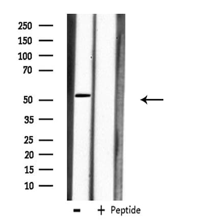 CPM / Carboxypeptidase M Antibody