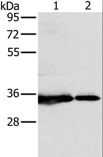 Polyclonal Rabbit anti-Human NDUFAF1 / CIA30 Antibody (WB)