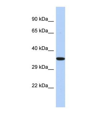 EPHX4 / Epoxide Hydrolase 4 Antibody (aa255-304)