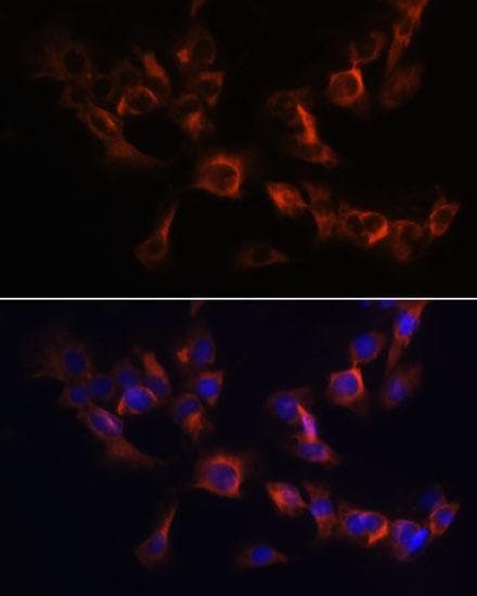 ARL13B Antibody