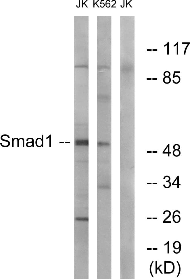 IHC-plus™ SMAD1 Antibody (aa153-202)