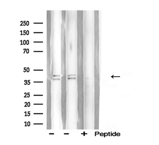 HNRNPA2B1 Antibody
