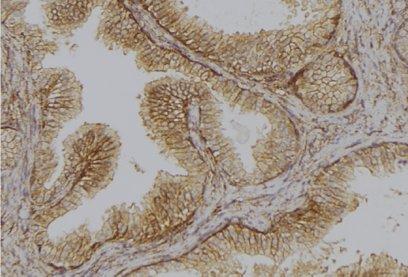 TMPRSS3 Antibody