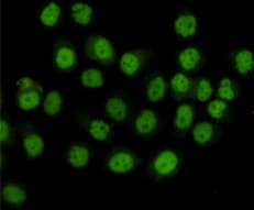 Monoclonal Mouse anti-Human SMC1A / SMC1 Antibody (WB)