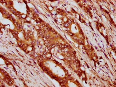 HIST1H4I Antibody