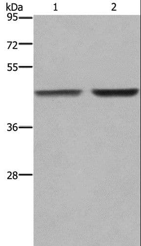 GABPB2 Antibody