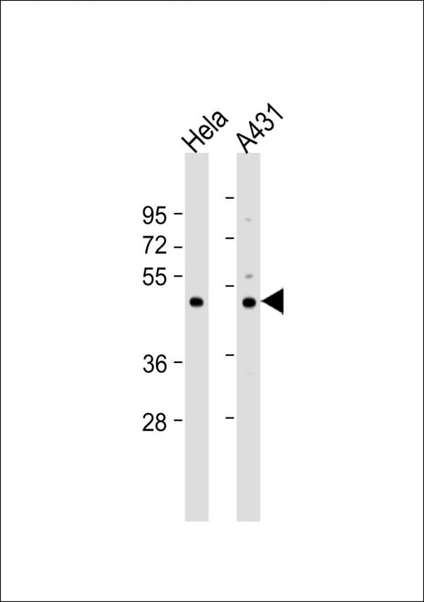 Polyclonal Rabbit anti-Human PABPC5 Antibody (WB)