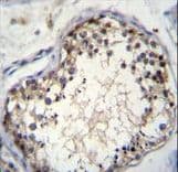 OVOS2 Antibody (aa99-128)