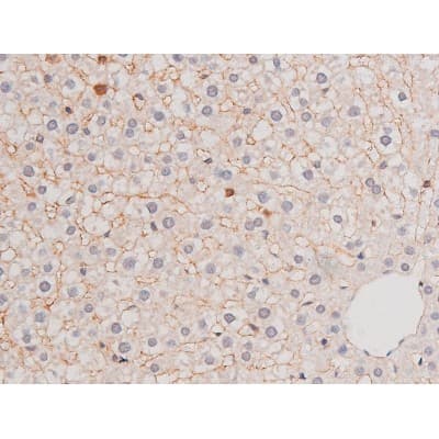 ADD1 / Adducin Alpha Antibody (phospho-Ser726)