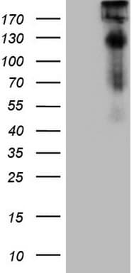 TP53BP1 / 53BP1 Antibody (aa1-300, clone OTI12D4)