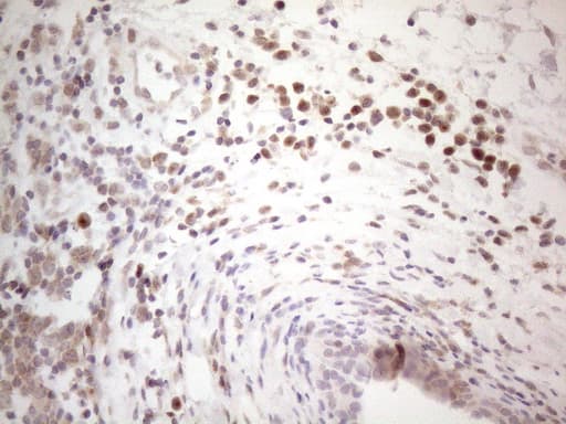 Monoclonal Mouse anti-Human BTBD10 / GMRP-1 Antibody (clone OTI7D3, IHC, WB)
