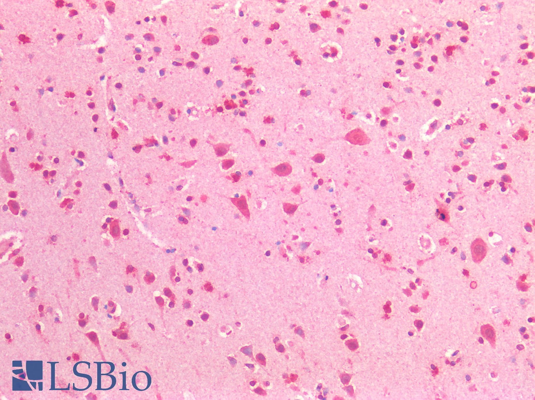IHC-plus™ BRCA1 Antibody (aa1848-1863)