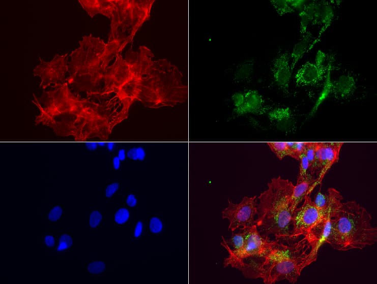 Monoclonal Mouse anti-Human ABAT Antibody (clone UMAB178, aa29-323, IHC, IF, WB)
