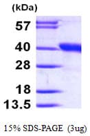 Human DDAH1 Protein (Recombinant His)