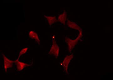 Polyclonal Rabbit anti-Human DOK1 Antibody (IHC, IF, WB)