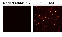 Polyclonal Rabbit anti-Human SLC6A14 Antibody (IHC, WB)