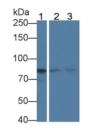 CD144 / CDH5 / VE Cadherin Antibody (aa68-307, PE)