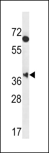 Polyclonal Rabbit anti-Human MBNL2 Antibody (aa261-290, IHC, WB)