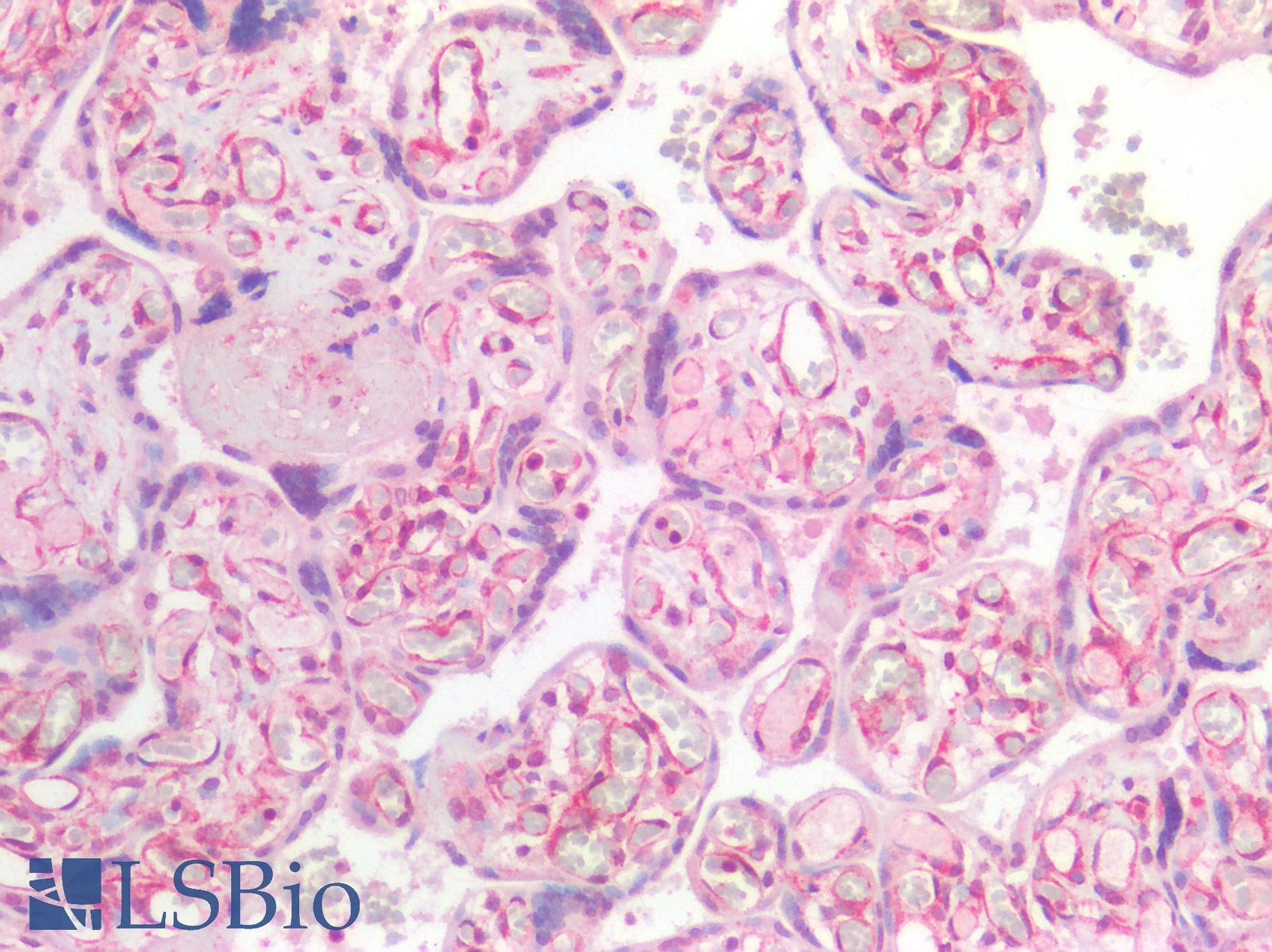 IHC-plus™ Polyclonal Rabbit anti-Human IL25 / IL17E Antibody (IHC)