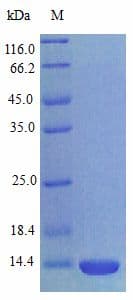 Rat VCC-1 / CXCL17 Protein (Recombinant)