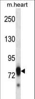 SCYL3 Antibody (aa671-699)