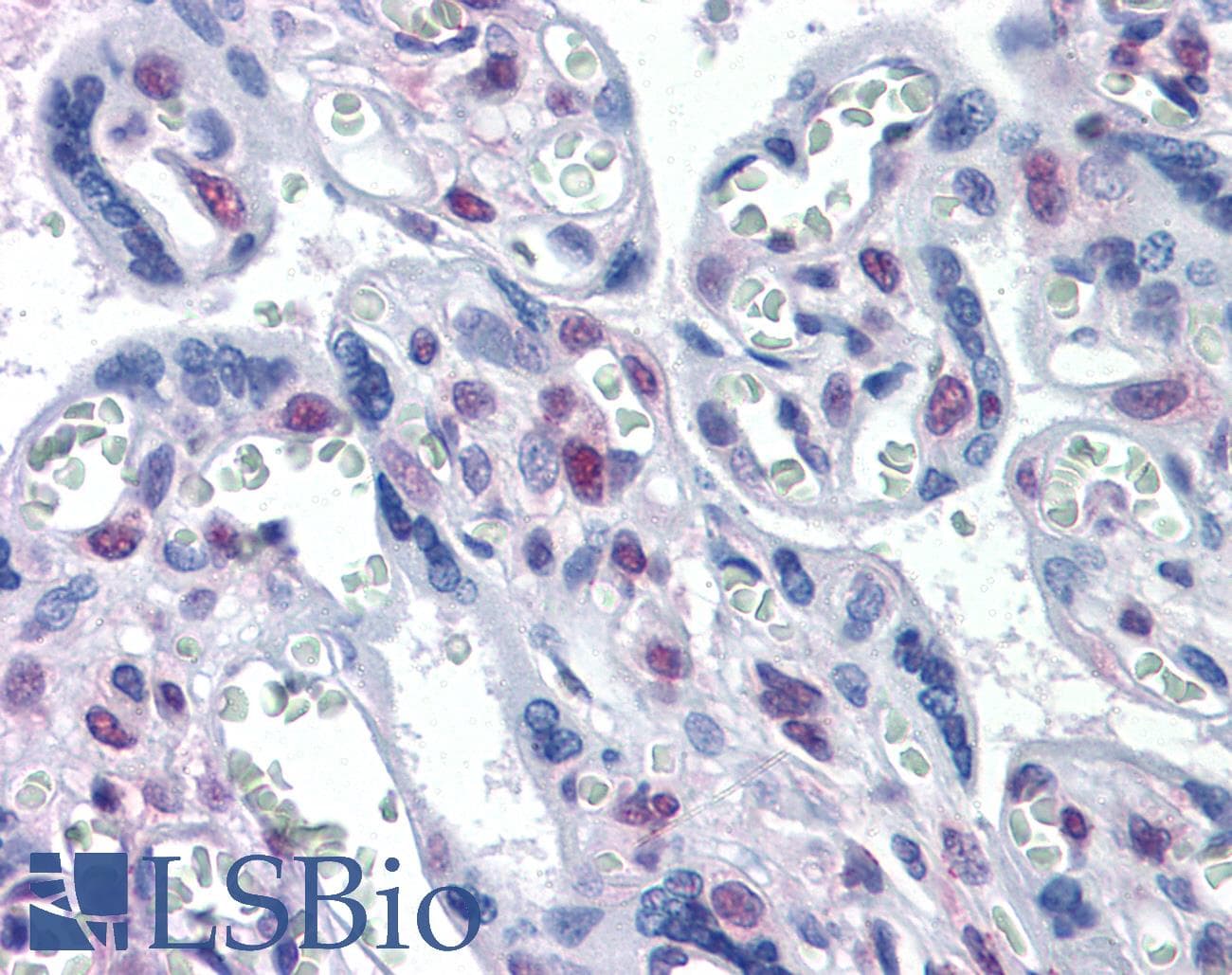 IHC-plus™ Monoclonal Mouse anti-Human DRAK1 / STK17A Antibody (clone 4D12, IHC, WB)