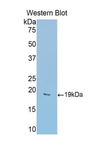 GDF2 / BMP9 Antibody (aa22-178, FITC)