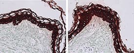 Cytokeratin 1+5+10+14 Antibody (clone 34βE12)