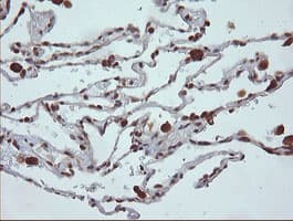MAP2K1 / MKK1 / MEK1 Antibody (clone OTI4B1)