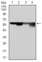 G6PDH Antibody (clone 2H7)
