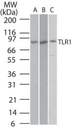 IHC-plus™ Polyclonal Rabbit anti-Human TLR1 Antibody (aa400-450, IHC, WB)