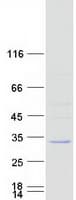 Human DBNDD1 Protein (Recombinant Myc-DDK (Flag))