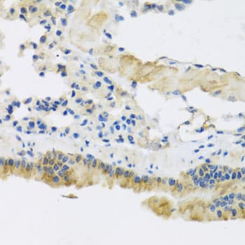Polyclonal Rabbit anti-Human CLIP1 / CLIP-170 Antibody (IHC, WB)
