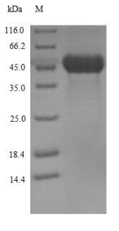 Streptolysin O Protein (Native)