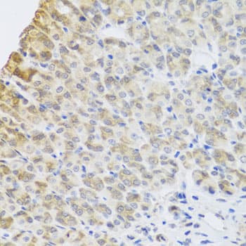 Polyclonal Rabbit anti-Human PER1 Antibody (IHC, WB)