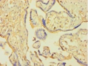 SNCA / Alpha-Synuclein Antibody (aa1-140, HRP)