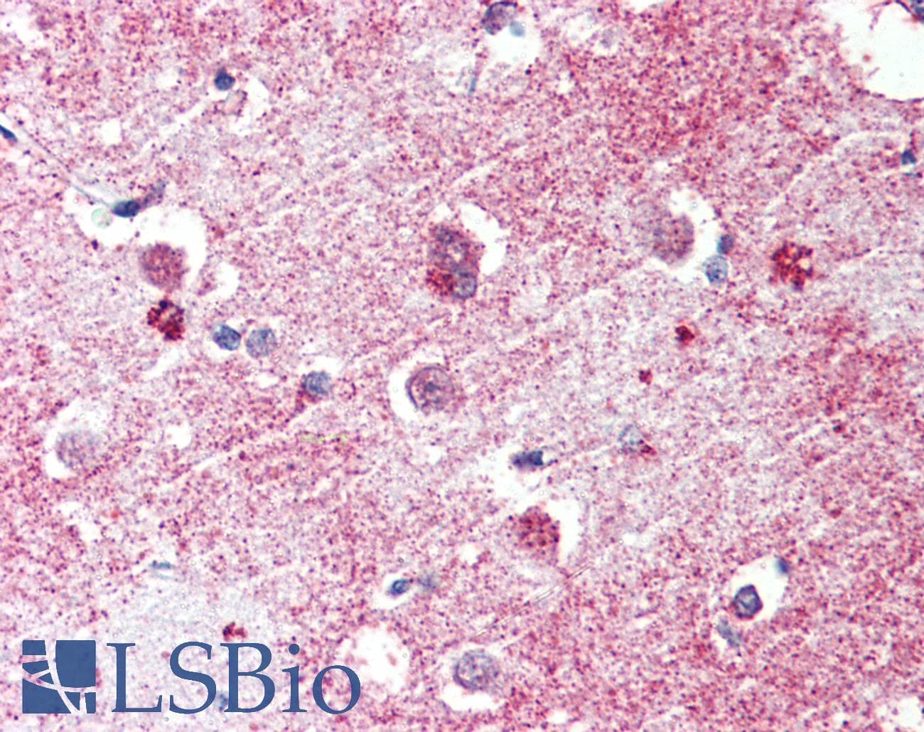 IHC-plus™ GPR26 Antibody (Internal)