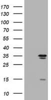 IHC-plus™ Monoclonal Mouse anti-Human TS / Thymidylate Synthase Antibody (clone 10F12, IHC, WB)