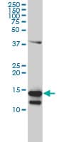 IHC-plus™ Monoclonal Mouse anti-Human CD247 / CD3 Zeta Antibody (clone 4A12-F6, IHC, WB)