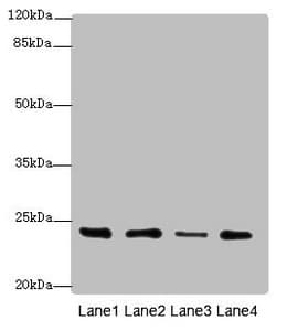 TNFAIP8 / SCC-S2 Antibody