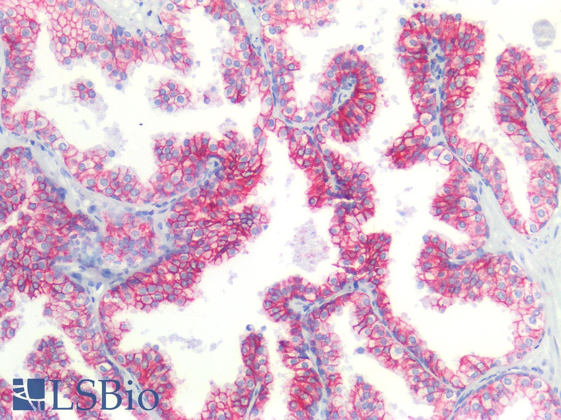 PathPlus™ Polyclonal Rabbit anti-Human CLDN3 / Claudin 3 Antibody (C-Terminus, IHC, IF, WB)