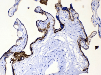 PLAP / Alkaline Phosphatase Antibody